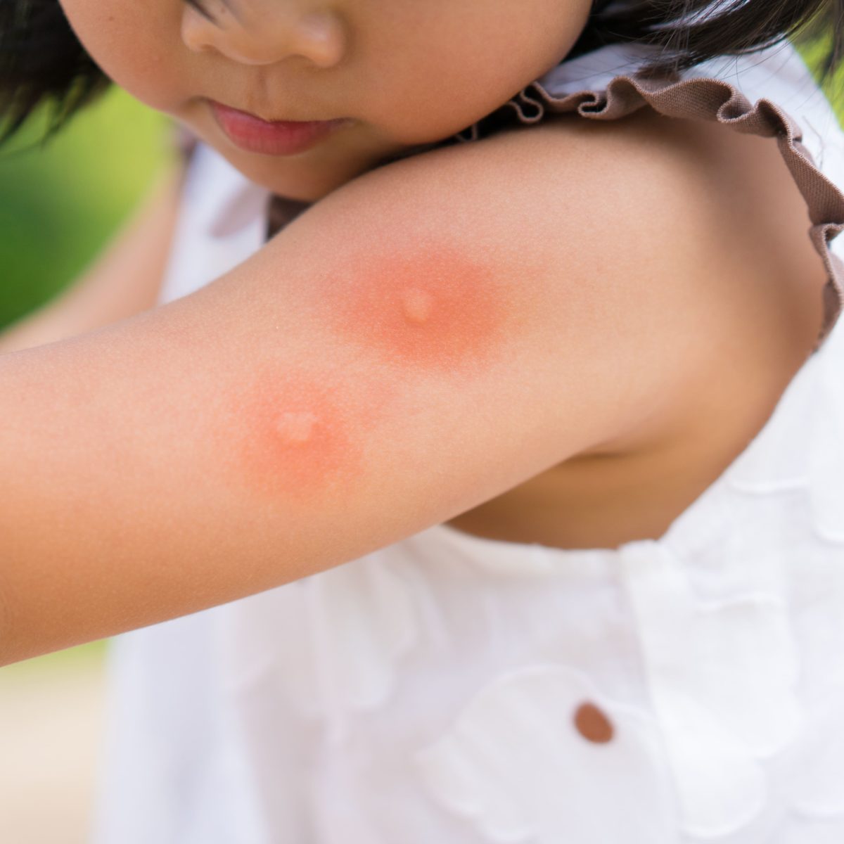 子供虫除けスプレーの選び方とは まずは安全で効果的な成分を把握しておきましょう Sheng Yuan Herbs