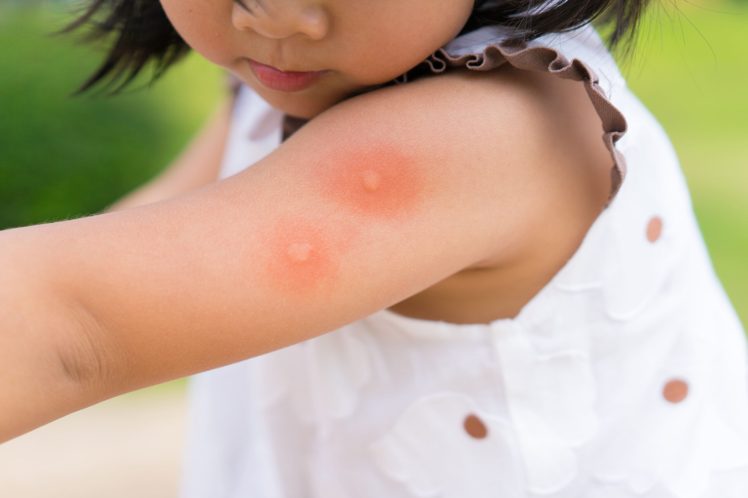 子供虫除けスプレーの選び方とは まずは安全で効果的な成分を把握しておきましょう Sheng Yuan Herbs